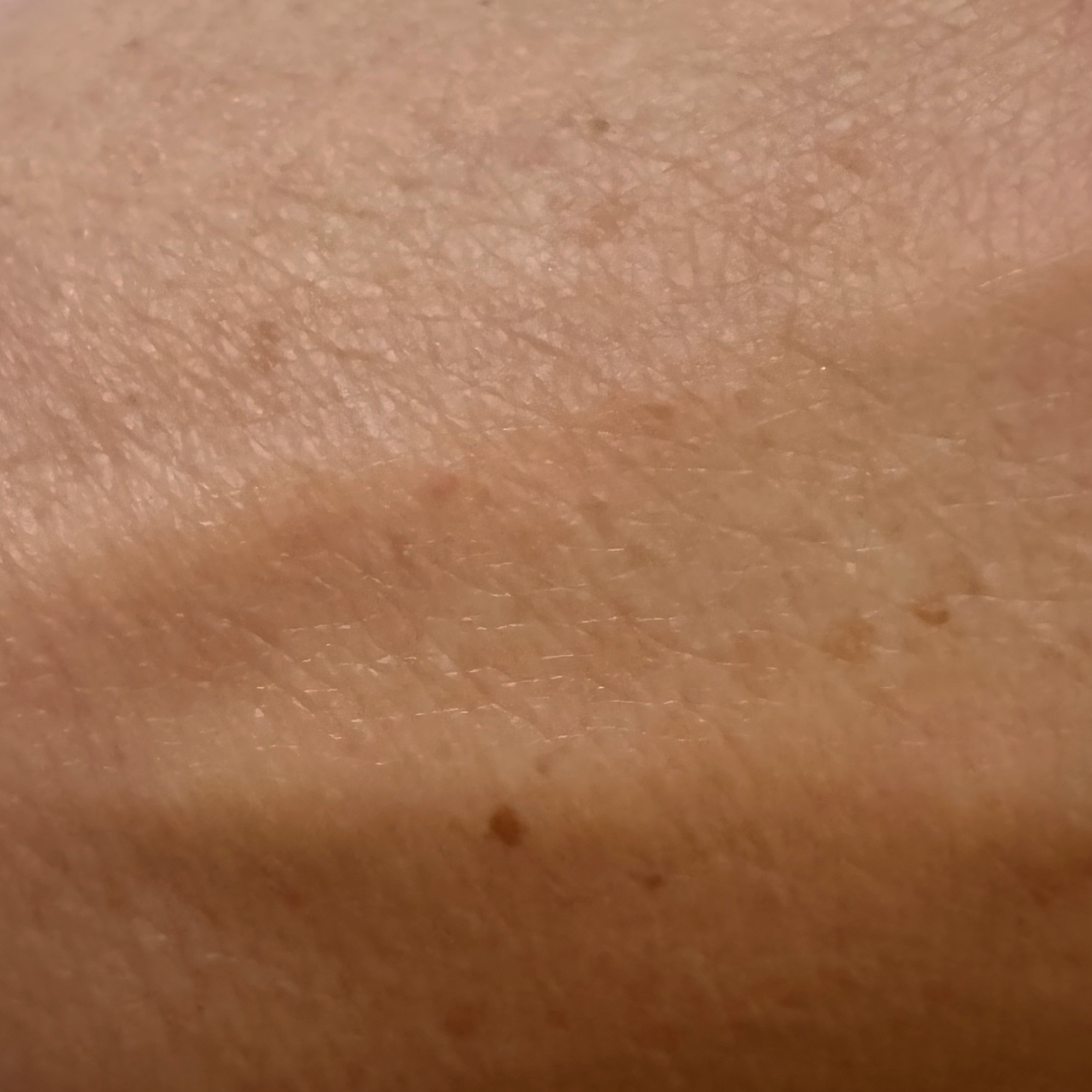 Reiyne Age Defy Daily Moisturizer shows a blurring effect in before and after photo