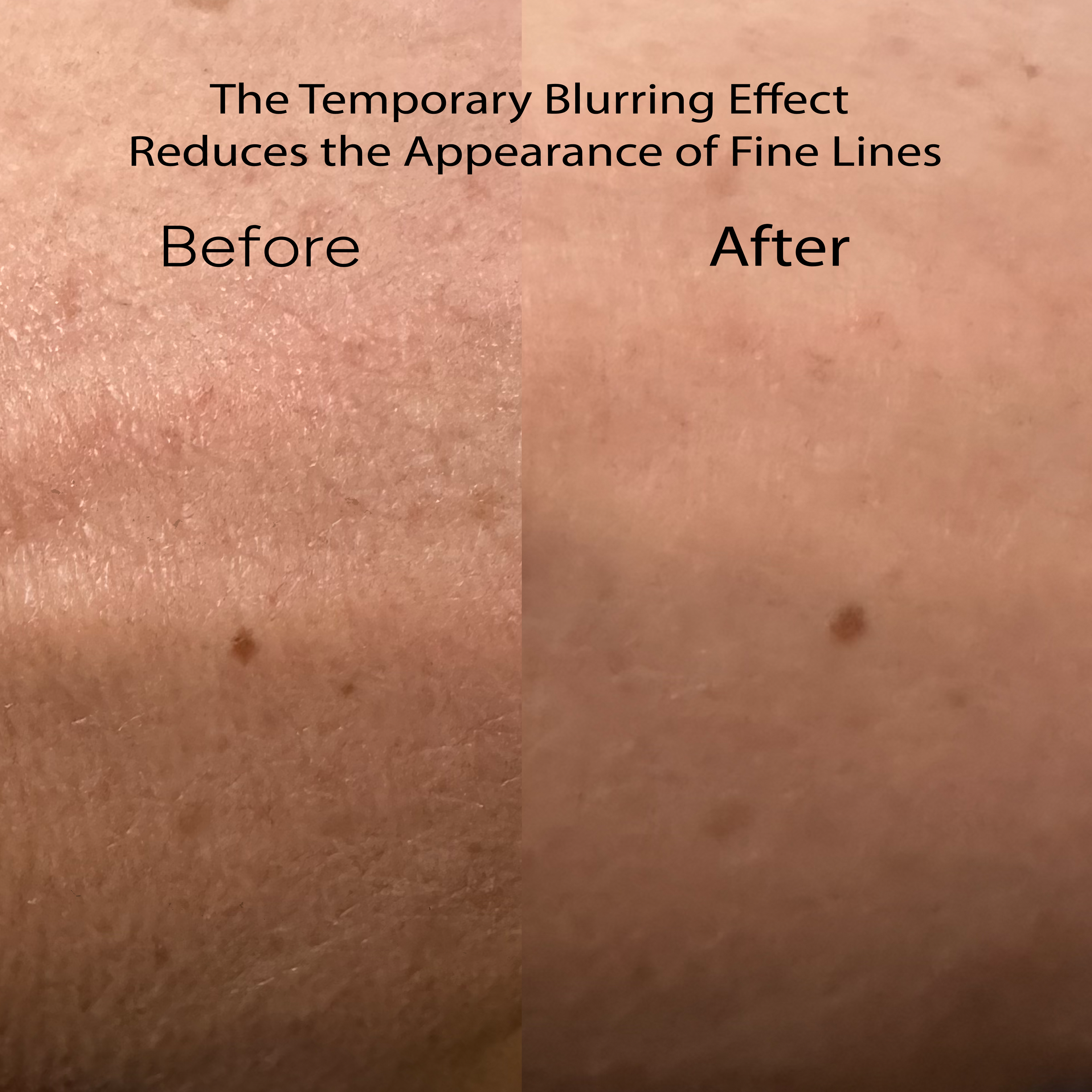 Reiyne Age Defy Daily Moisturizer shows a blurring effect in before and after photo