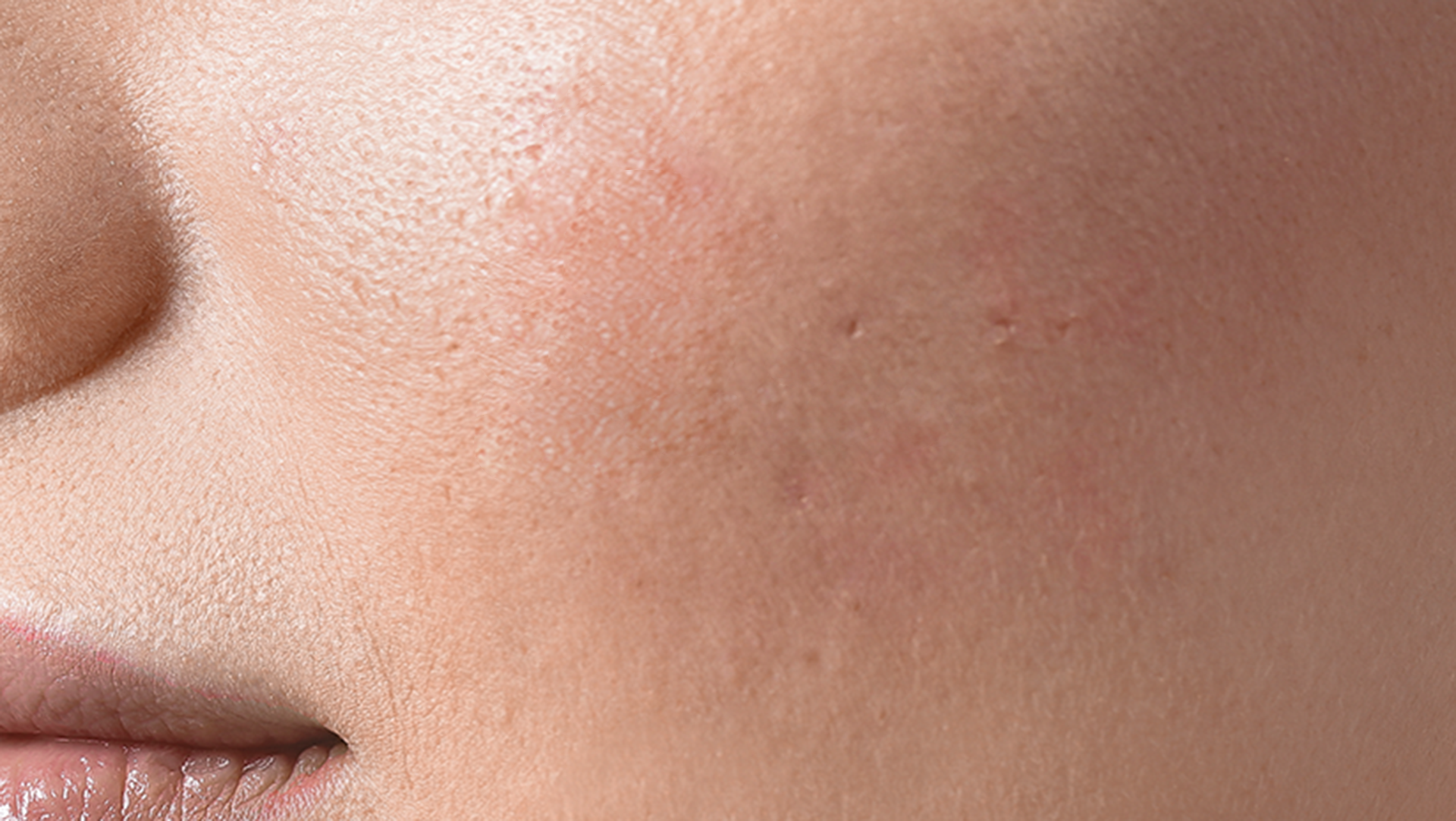 Reiyne Zap It! Blemish Spot Treatment in white airless point with purple and white label