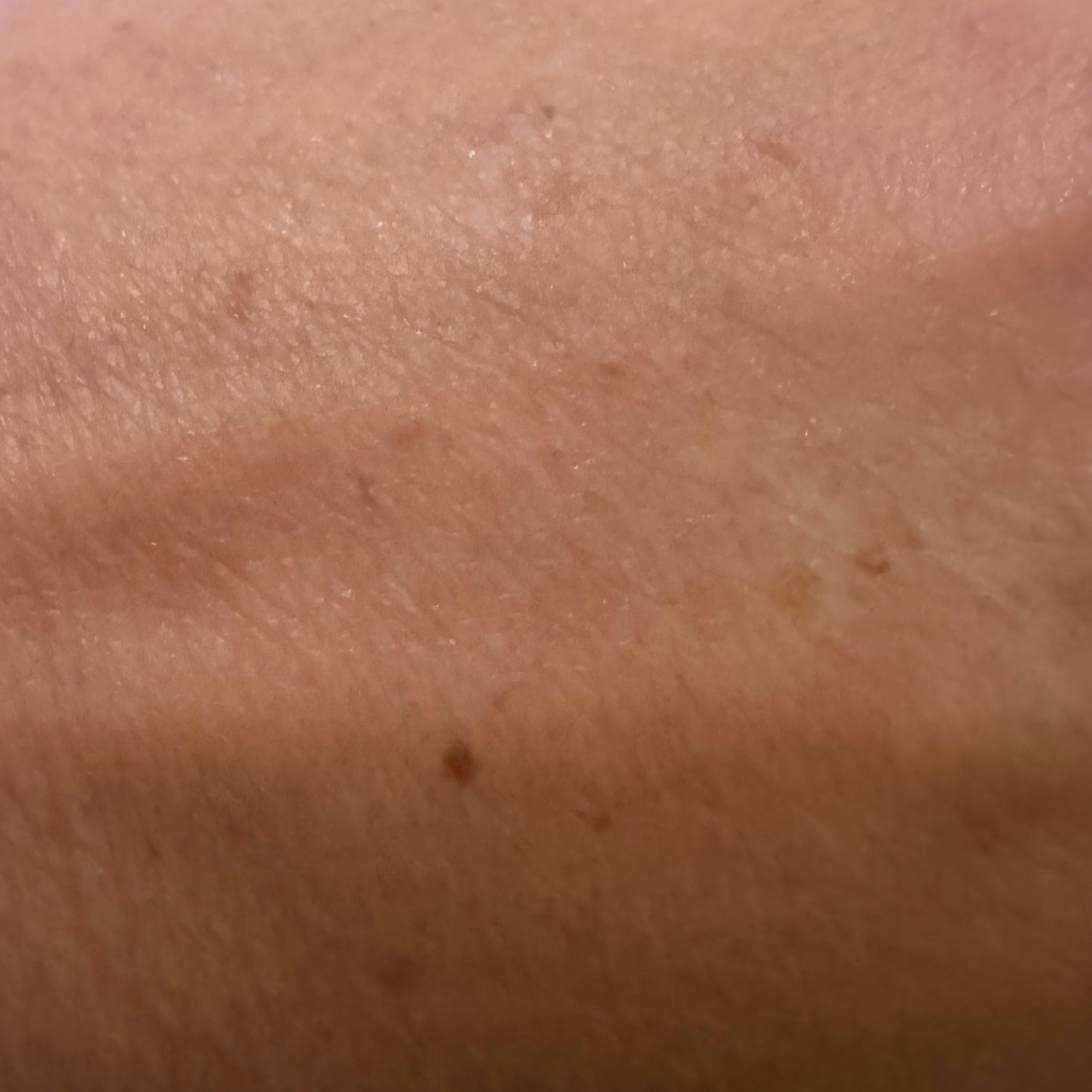 Reiyne Age Defy Daily Moisturizer shows a blurring effect in before and after photo