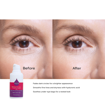 Reiyne Bright Eyes - Under Eye Cream for Dark Circles and Puffiness white airless pump bottle with purple and pink label